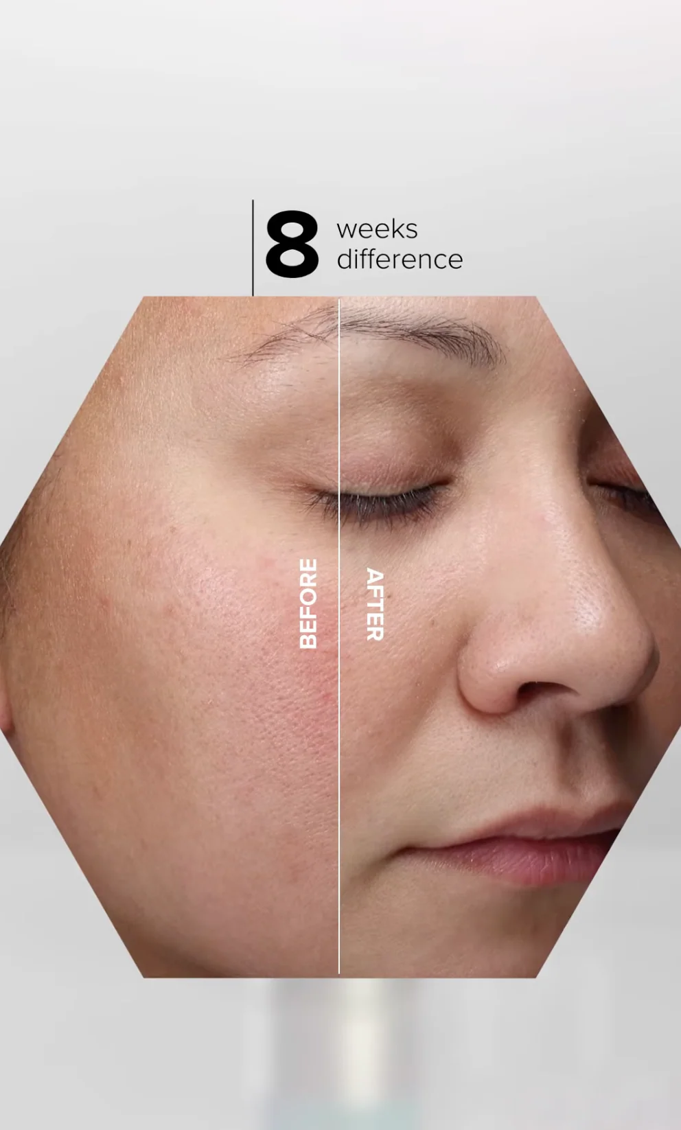 HA (Hyaluronic Acid) Immerse Serum 30ml - Image 6