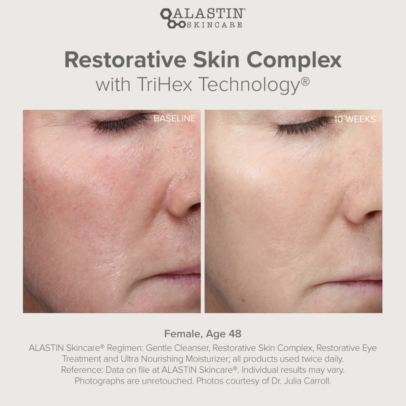 Restorative Skin Complex with TriHex+ 29ml - Image 3