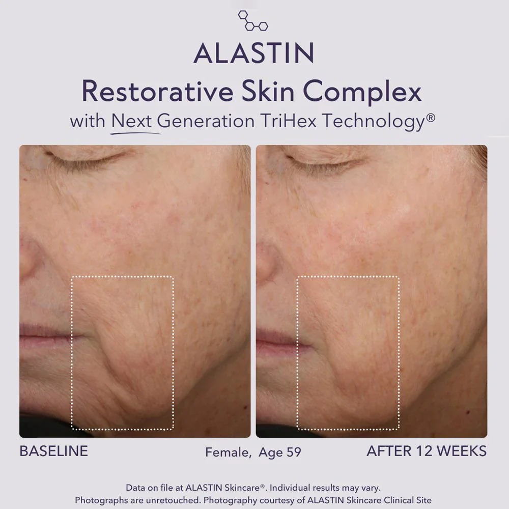 Restorative Skin Complex with TriHex+ 29ml - Image 6